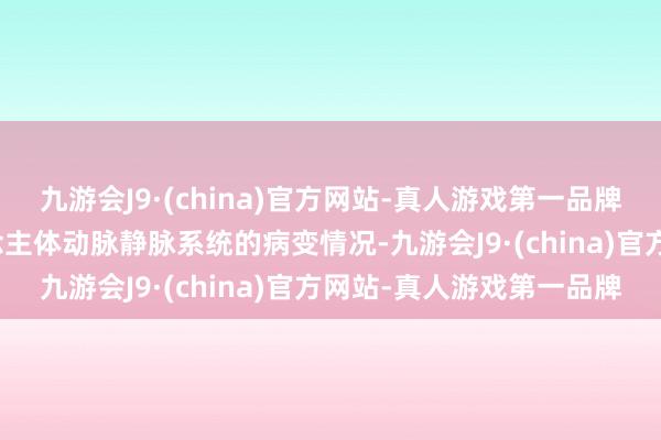 九游会J9·(china)官方网站-真人游戏第一品牌4.血管外科：计划东说念主体动脉静脉系统的病变情况-九游会J9·(china)官方网站-真人游戏第一品牌